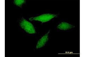 Immunofluorescence of purified MaxPab antibody to ANXA11 on HeLa cell.