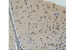 IHC-P analysis of brain tissue, with DAB staining. (CYP26A1 anticorps  (AA 250-495))