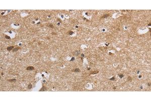Immunohistochemistry of paraffin-embedded Human brain using SDCCAG3 Polyclonal Antibody at dilution of 1:30 (SDCCAG3 anticorps)