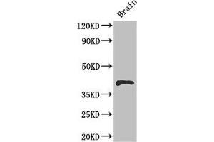 Western Blot Positive WB detected in: Mouse brain tissue All lanes: RBM4 antibody at 2. (RBM4 anticorps  (AA 121-205))