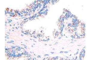 Detection of Hsp60 in Human Prostate Tissue using Polyclonal Antibody to Heat Shock Protein 60 (Hsp60)