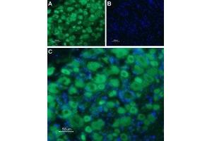 Expression of Serotonin receptor 3B in rat DRG - Immunohistochemical staining of rat dorsal root ganglion (DRG) frozen sections using Anti-5HT3B Receptor (HTR3B) (extracellular) Antibody (ABIN7043622 and ABIN7045285), followed by goat anti-rabbit-AlexaFluor-488 secondary antibody.