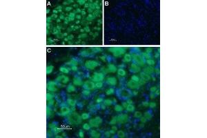 Expression of Serotonin receptor 3B in rat DRG - Immunohistochemical staining of rat dorsal root ganglion (DRG) frozen sections using Anti-5HT3B Receptor (HTR3B) (extracellular) Antibody (ABIN7043622 and ABIN7045285), followed by goat anti-rabbit-AlexaFluor-488 secondary antibody. (Serotonin Receptor 3B anticorps  (Extracellular, N-Term))