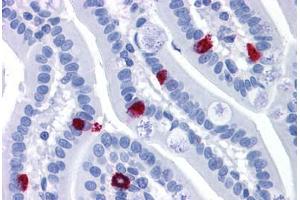 Human Small Intestine: Formalin-Fixed, Paraffin-Embedded (FFPE) (GCC2 anticorps  (AA 1174-1185))