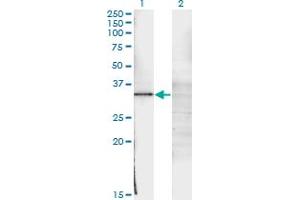 Western Blot analysis of WT1 expression in transfected 293T cell line by WT1 monoclonal antibody (M02), clone 3B12. (WT1 anticorps  (AA 349-439))