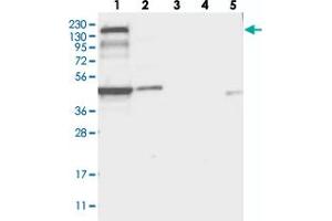 Western blot analysis of Lane 1: RT-4, Lane 2: U-251 MG, Lane 3: Human Plasma, Lane 4: Liver, Lane 5: Tonsil with PLEKHA5 polyclonal antibody . (PLEKHA5 anticorps)