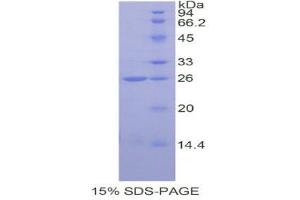 SDS-PAGE (SDS) image for Catechol-O-Methyltransferase (COMT) (AA 52-271) protein (His tag) (ABIN1877748)