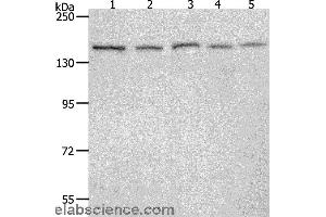 Western blot analysis of 293T, Hela, K562, NIH/3T3 and RAW264. (RAD50 anticorps)