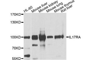 Western blot analysis of extracts of various cells, using IL17RA antibody. (IL17RA anticorps)