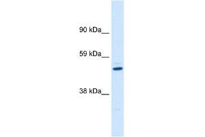 WB Suggested Anti-KCNAB1 Antibody Titration:  0. (KCNAB1 anticorps  (C-Term))