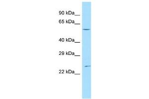 Host:  Rabbit  Target Name:  Ankrd13c  Sample Type:  Mouse Testis lysates  Antibody Dilution:  1. (ANKRD13C anticorps  (C-Term))