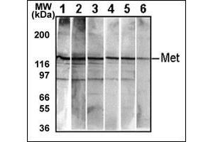 Detection of endogenous Met in HepG2 cell line. (c-MET anticorps  (Catalytic Domain))