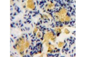 Used in DAB staining on fromalin fixed paraffin-embedded Bowels tissue (PKC zeta anticorps  (AA 404-591))