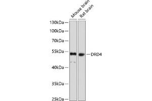 Western blot analysis of extracts of various cell lines, using DRD4 antibody (ABIN1679595, ABIN5663875, ABIN5663877 and ABIN6217338) at 1:1000 dilution. (DRD4 anticorps  (AA 100-200))