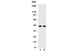 Western blot testing of CXCR5 antibody and Lane 1:  rat spleen (CXCR5 anticorps  (C-Term))