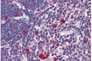 Human Thymus: Formalin-Fixed, Paraffin-Embedded (FFPE)