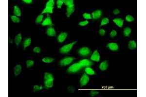 Immunofluorescence of monoclonal antibody to CHUK on HeLa cell.