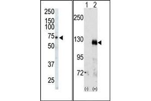 (LEFT)Western blot analysis of anti-EphA3 Pab in CHO cell lysate. (EPH Receptor A3 anticorps  (C-Term))