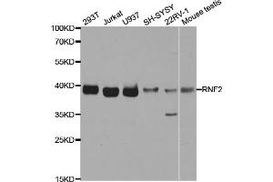 Western blot analysis of extracts of various cell lines, using RNF2 antibody (ABIN5973244) at 1/1000 dilution.