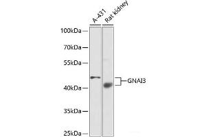 Western blot analysis of extracts of various cell lines using GNAI3 Polyclonal Antibody at dilution of 1:1000. (GNAI3 anticorps)