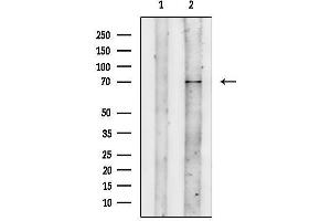 anti-Interferon alpha/beta Receptor 2 (IFNAR2) (C-Term) antibody
