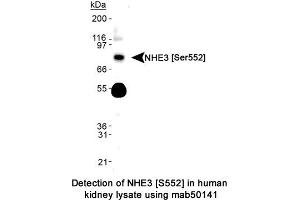 Image no. 1 for anti-Solute Carrier Family 9 (Sodium/hydrogen Exchanger), Member 3 (SLC9A3) (pSer552) antibody (ABIN363295)