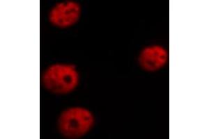 ABIN6267526 staining HepG2 cells by ICC/IF. (GATA4 anticorps  (pSer105))