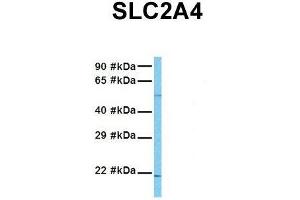 Host:  Rabbit  Target Name:  SLC2A4  Sample Tissue:  Human MCF7  Antibody Dilution:  1. (GLUT4 anticorps  (N-Term))