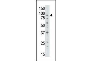 The anti-ABCB7 C-term Pab (ABIN390062 and ABIN2840589) is used in Western blot to detect ABCB7 in Jurkat cell lysate.