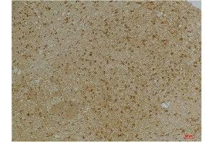 Immunohistochemical analysis of paraffin-embedded Mouse BrainTissue using KCNN2(SK2) Rabbit pAb diluted at 1:200. (KCNN2 anticorps)