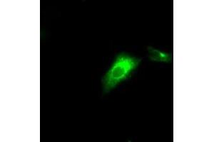 Image no. 6 for anti-Lipase, Endothelial (LIPG) antibody (ABIN1499169) (LIPG anticorps)