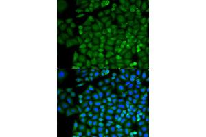 Immunofluorescence analysis of HeLa cell using SELENBP1 antibody. (SELENBP1 anticorps)