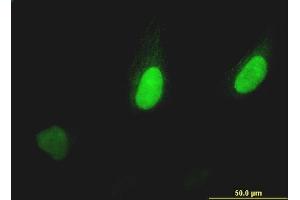 Immunofluorescence of monoclonal antibody to PUM2 on HeLa cell.