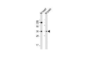 All lanes : Anti-HUN-LDHB at 1:2000 dilution Lane 1: Mouse heart whole cell lysate Lane 2: Mouse brain whole cell lysate Lysates/proteins at 20 μg per lane. (LDHB anticorps  (AA 220-250))