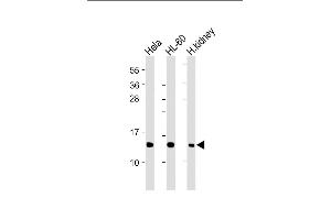 All lanes : Anti-ND4L Antibody (C-term) at 1:2000 dilution Lane 1: Hela whole cell lysate Lane 2: HL-60 whole cell lysate Lane 3: Human kidney lysate Lysates/proteins at 20 μg per lane. (MT-ND4L anticorps  (C-Term))