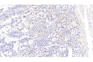 Detection of DR5 in Human Small intestine Tissue using Polyclonal Antibody to Death receptor 5 (DR5) (TNFRSF10B anticorps  (AA 234-435))