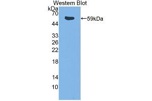 Western blot analysis of the recombinant protein. (ITK anticorps  (AA 368-625))