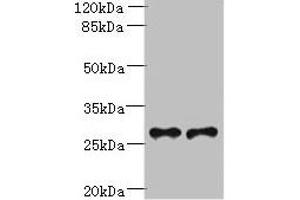 Western blot All lanes: Trem2 antibody at 6 μg/mL Lane 1: Mouse liver tissue Lane 2: THP-1 whole cell lysate Secondary Goat polyclonal to rabbit IgG at 1/10000 dilution Predicted band size: 25, 28 kDa Observed band size: 28 kDa (TREM2 anticorps  (AA 19-171))