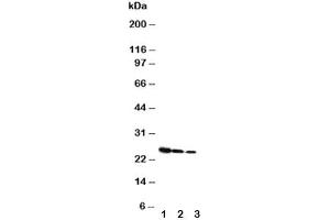 Western blot testing of Growth Hormone antibody and Lane 1:  Recombinant rat GH protein 10ng (Growth Hormone 1 anticorps  (AA 27-216))