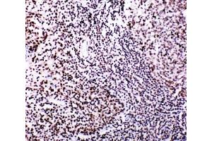 IHC-P: MYBL2 antibody testing of human tonsil tissue.