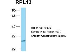 Host:  Rabbit  Target Name:  RPL13  Sample Type:  MCF7  Antibody Dilution:  1.