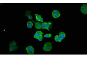 Immunofluorescence staining of MCF-7 cells with ABIN7146960 at 1:66, counter-stained with DAPI.