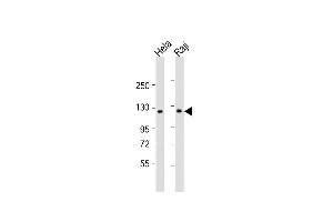 All lanes : Anti-NFKB(p100) Antibody (C-term /870) at 1:1000 dilution Lane 1: Hela whole cell lysate Lane 2: Raji whole cell lysate Lysates/proteins at 20 μg per lane.