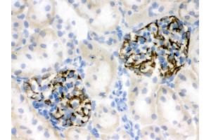 IHC analysis of Nestin using anti-Nestin antibody .