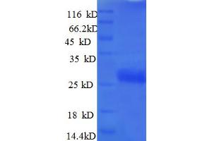 SDS-PAGE (SDS) image for Vascular Endothelial Growth Factor A (VEGFA) (AA 27-232) protein (His tag) (ABIN5712562)
