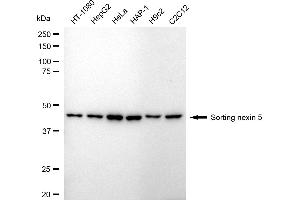 Western blotting analysis using Sorting nexin 5 antibody (ABIN7800410).