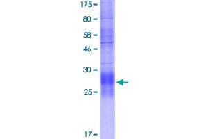 Image no. 1 for Tumor Necrosis Factor (Ligand) Superfamily, Member 11 (TNFSF11) (AA 158-317) protein (His-DYKDDDDK-Strep II Tag) (ABIN1323211)