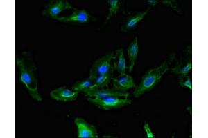 anti-Cell Division Cycle 37 Homolog (S. Cerevisiae) (CDC37) (AA 89-175) antibody