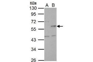 WB Image Sample (30 ug of whole cell lysate) A: HeLa B: HeLa nucleus 10% SDS PAGE antibody diluted at 1:5000 (NUF2 anticorps)