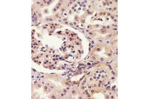 (ABIN6242751 and ABIN6578805) staining SYNE2 in human kidney tissue sections by Immunohistochemistry (IHC-P - paraformaldehyde-fixed, paraffin-embedded sections). (SYNE2 anticorps  (AA 1843-1877))